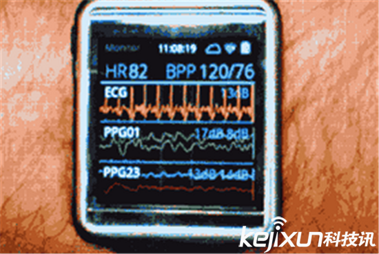 你真的需要一塊iwatch?iwatch功能介紹