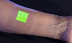 新型“智能繃帶” 能提醒你傷口是否感染