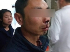 因要求實(shí)名簽收 快遞員遭暴打致鼻梁骨折