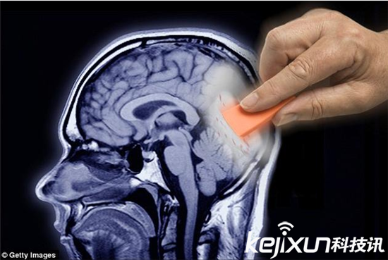 磁鐵能喚醒些忘卻的記憶 或有助治療精神分裂癥患者